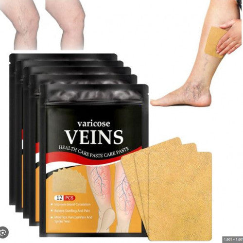 Parches para Várices – Alivio Natural para Piernas Cansadas y Pesadas