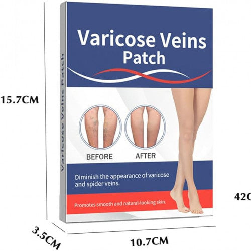 Parche para Venas Varicosas – Alivio Calmante y Mejora Visible